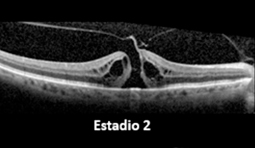 Estado 2