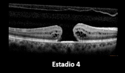 Estado 4